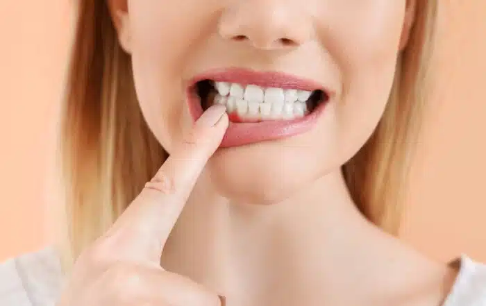 Woman with healthy teeth closeup