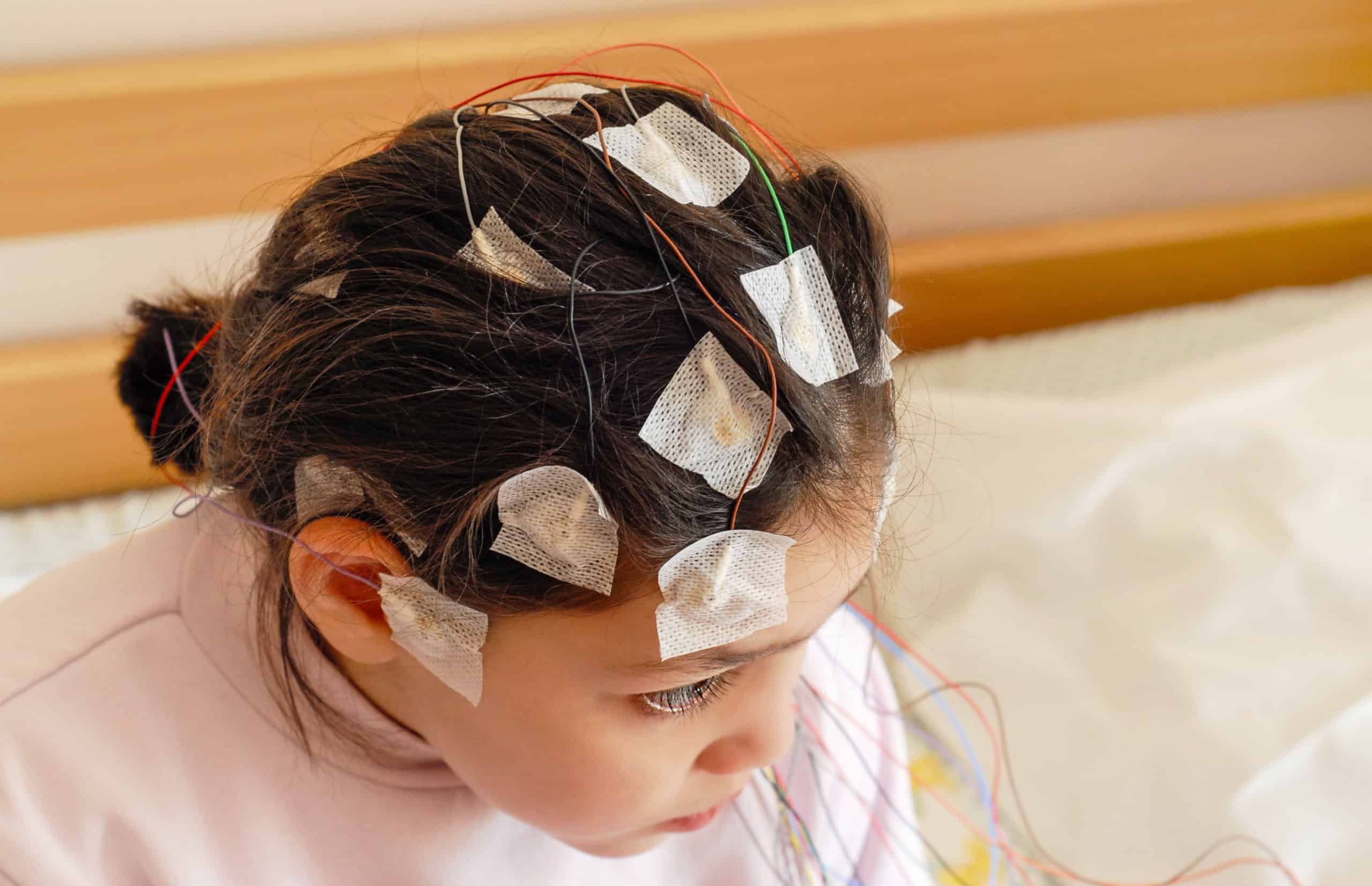 Girl with EEG electrodes attached to her head