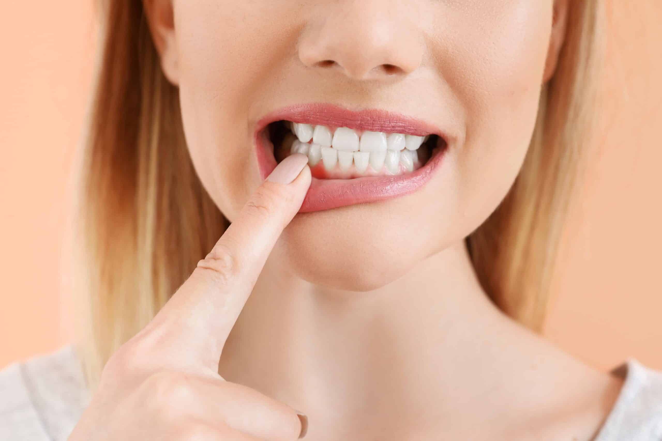 Woman with healthy teeth closeup