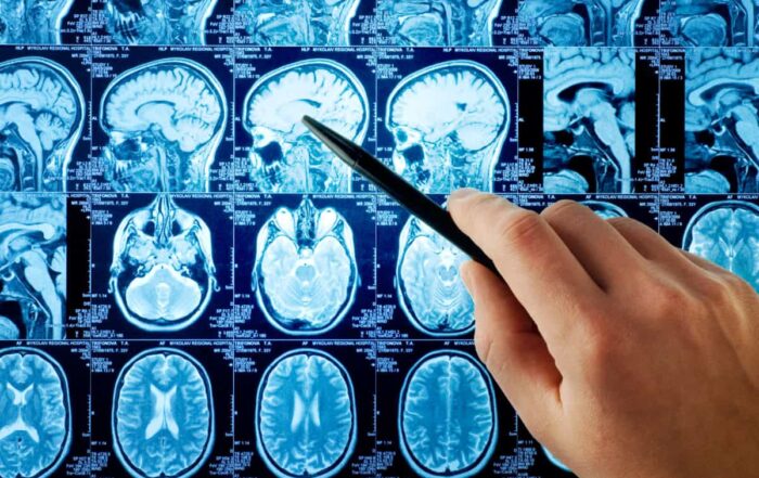Close-up view of a brain scan showing detailed brain structure