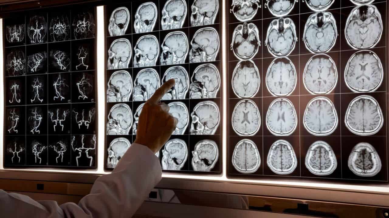 Doctor analyzing brain scans on a monitor